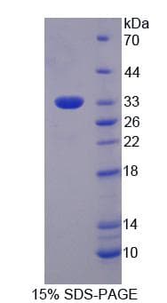 Human EIF3M / PCID1 Protein (Recombinant His, N-Terminal)