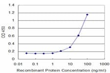 Monoclonal Mouse anti-Human CYP2D6 Antibody (clone 2C5)