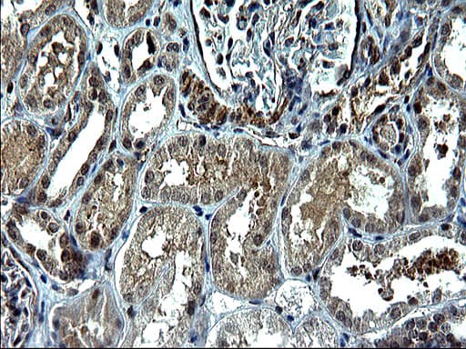 TNF Alpha Antibody (clone OTI1D9)