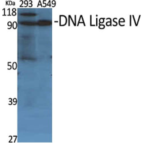 LIG4 / DNA Ligase IV Antibody (560-640 aa, Internal)