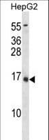 Osteocalcin Antibody (aa66-100)