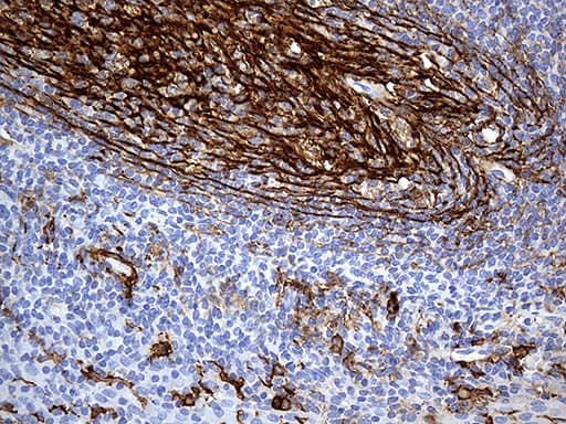 CD14 Antibody (aa20-87, clone OTI10C2)