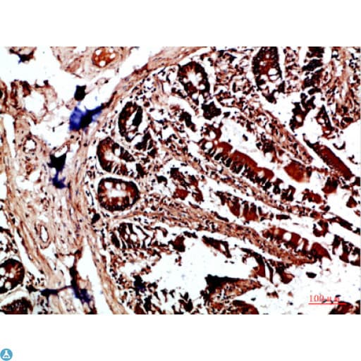 Polyclonal Rabbit anti-Human HLA-DQA1 Antibody (IHC)
