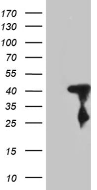 SHARPIN Antibody (aa1-326, clone OTI2B1, Carrier-free)