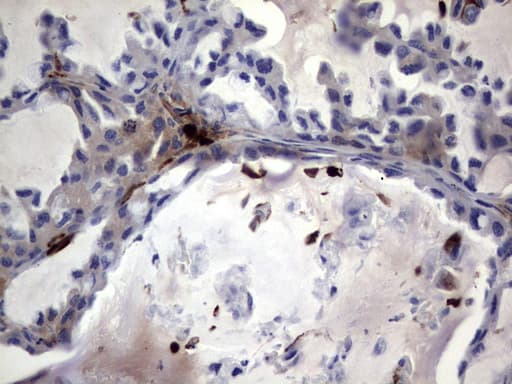 S100A9 / MRP14 Antibody (clone OTI7B1)