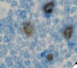 IL2RA / CD25 Antibody (clone 4C9)
