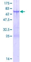 Human TRIM44 Protein (Recombinant GST)