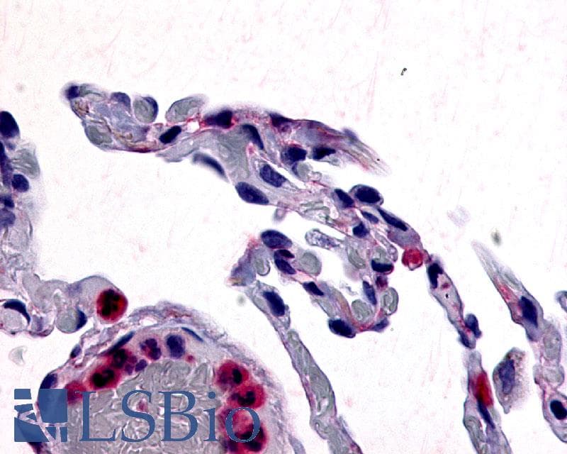 PathPlus™ CCR1 Antibody (Extracellular Domain)