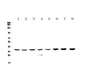 HNRNPA2B1 Antibody