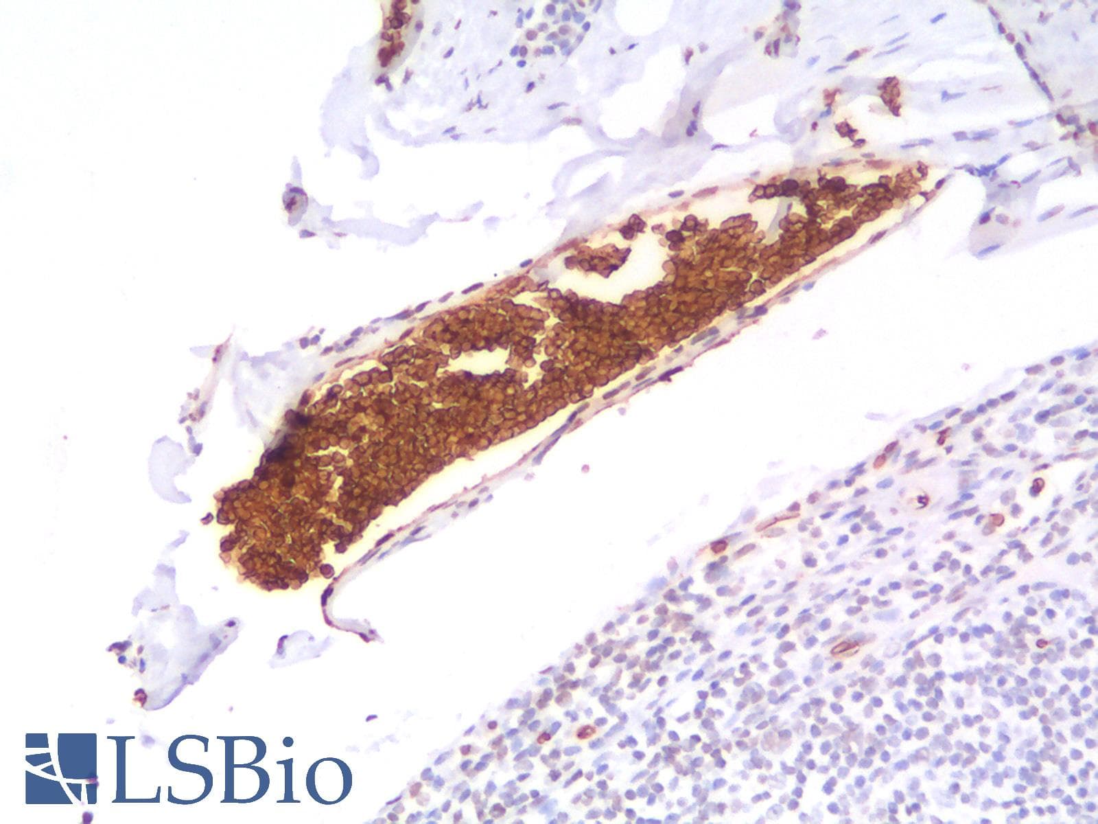 PathPlus™ Recombinant Monoclonal Rabbit anti-Human GYPA / CD235a / Glycophorin A Antibody (clone GYPA/1725R, IHC)