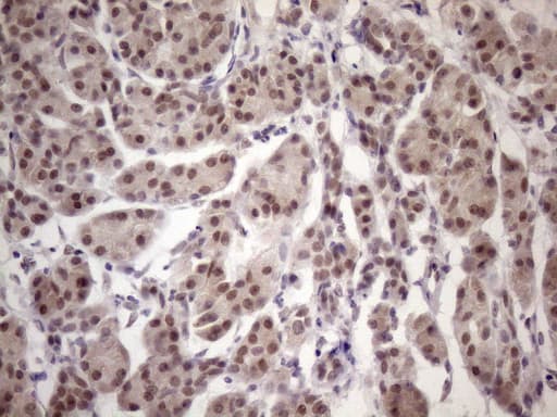 Monoclonal Mouse anti-Human ESRRA / ERR Alpha Antibody (clone OTI2C12, aa1-205, IHC, WB)