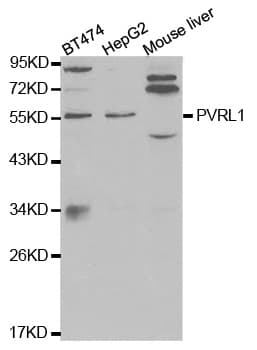IHC-plus™ Nectin-1 / PVRL1 Antibody
