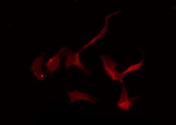 Polyclonal Rabbit anti-Human SLC16A2 / MCT8 Antibody (IF, WB)