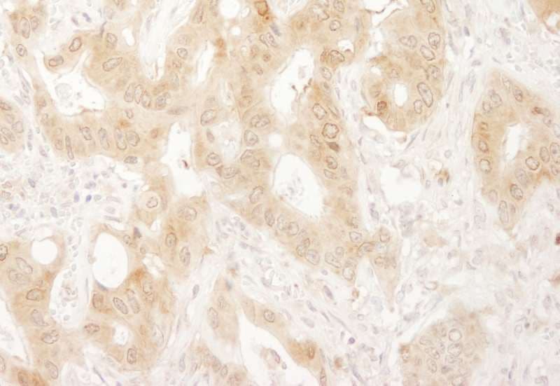 PXN / Paxillin Antibody (aa1-50)