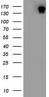 DOT1L / DOT1 Antibody (aa1008-1424, clone OTI3E9)