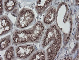 ESRRG / ERR Gamma Antibody (aa24-263, clone OTI1E5)