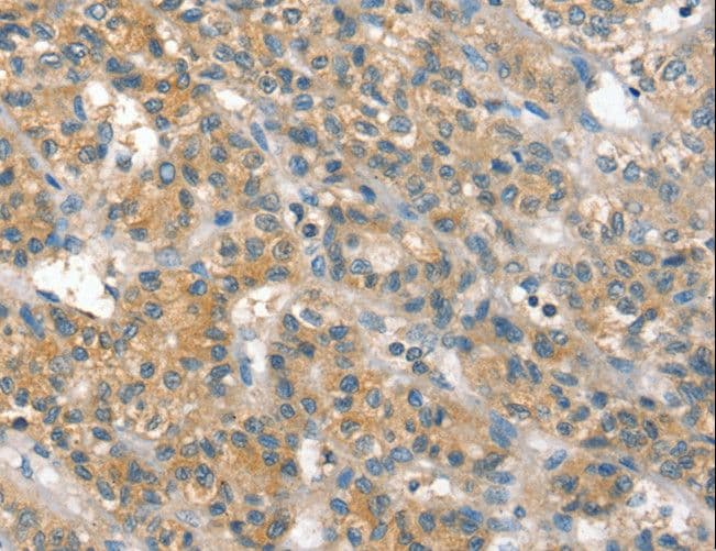 Polyclonal Rabbit anti-Human PP2Ac / PPP2CA Antibody (IHC, WB)