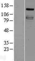 Human IRS4 Protein (Over-Expression Lysate Myc-DDK (Flag))