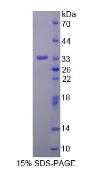 Human ANTXR2 / CMG2 Protein (Recombinant His-T7)