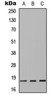 SNCA / Alpha-Synuclein Antibody (Internal)