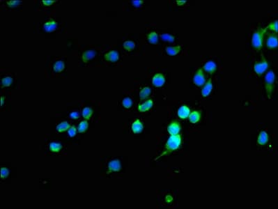 OPALIN / TMEM10 Antibody