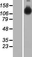 HELB Protein (Over-Expression Lysate Myc-DDK (Flag))