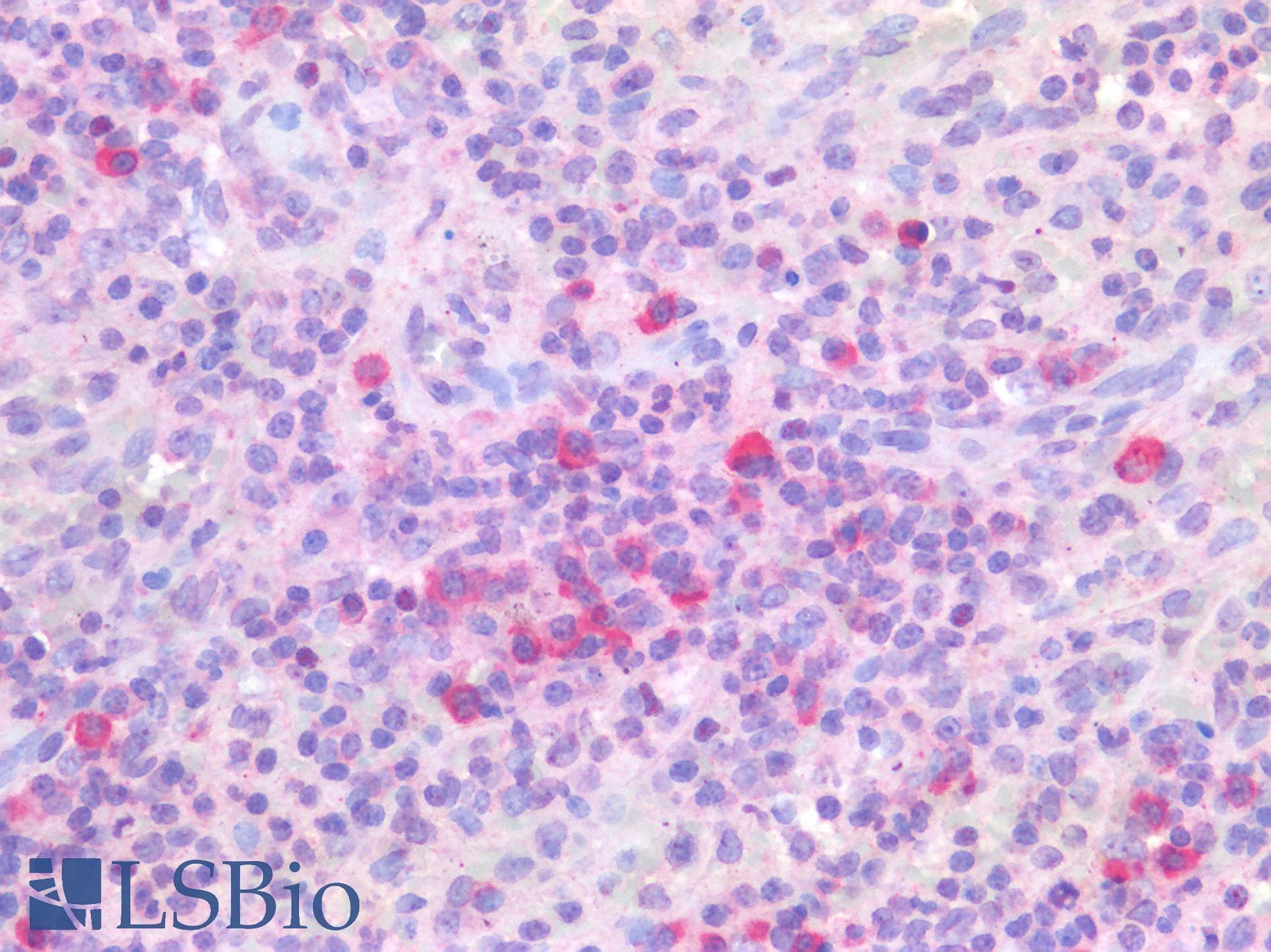IHC-plus™ PIM1 / Pim-1 Antibody