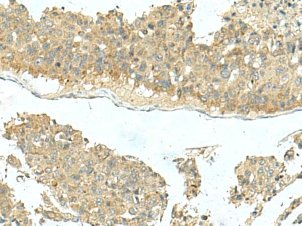 Polyclonal Rabbit anti-Human KIR2DL5A / KIR2DL5 Antibody (IHC, WB)
