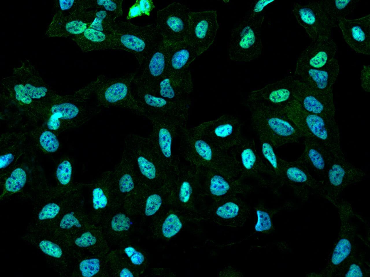 SMARCE1 / BAF57 Antibody