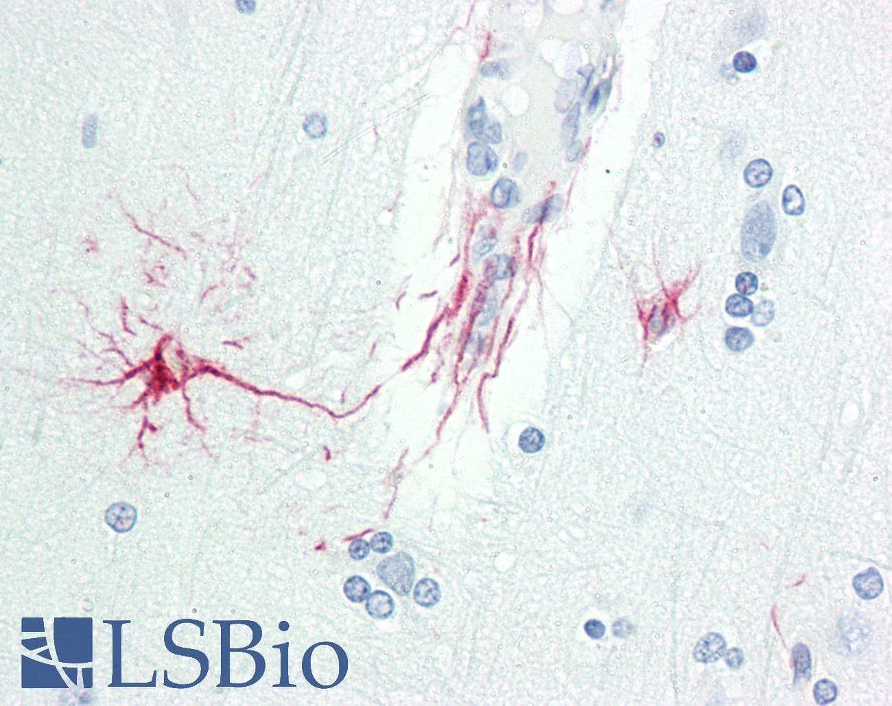 IHC-plus™ Polyclonal Rabbit anti-Human DOK6 Antibody (aa111-160, IHC, IF, WB)
