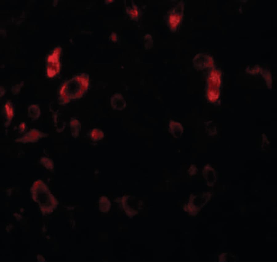 Polyclonal Rabbit anti-Human PIAS2 / PIASX Antibody (IHC, IF, WB)