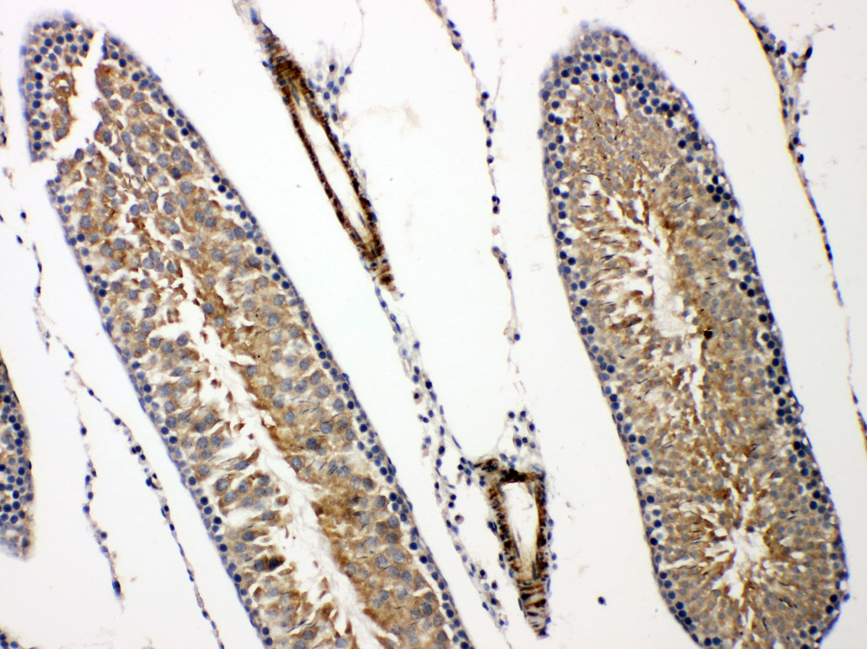 PRLR / Prolactin Receptor Antibody (aa591-605)