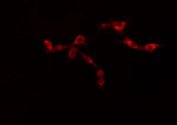 Polyclonal Rabbit anti-Human HSP90B1 / GP96 / GRP94 Antibody (IHC, IF, WB)