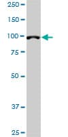 DPYD / DPD Antibody (clone 7D4)