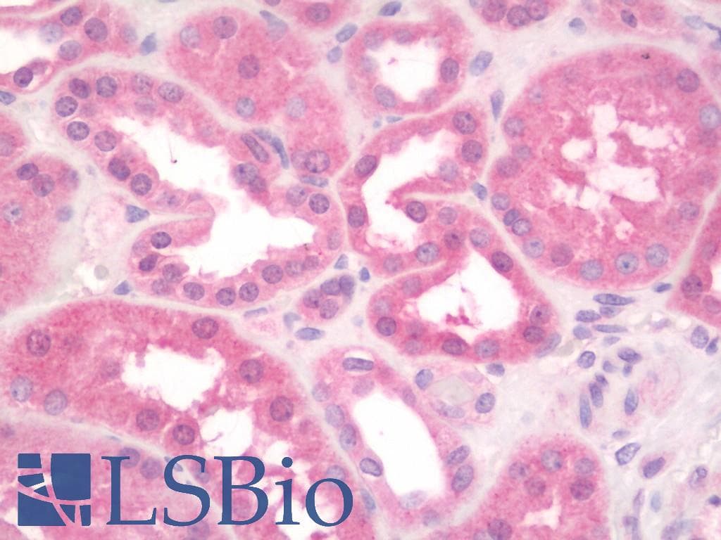 IHC-plus™ Polyclonal Rabbit anti-Human APG5 / ATG5 Antibody (aa1-30, IHC, IF, WB)