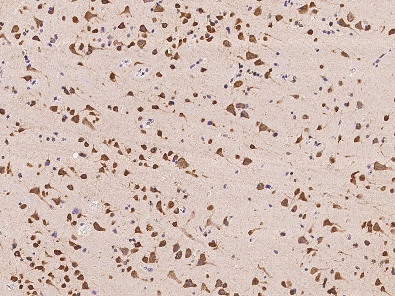 Polyclonal Rabbit anti-Human NOLC1 Antibody (IHC, IF)