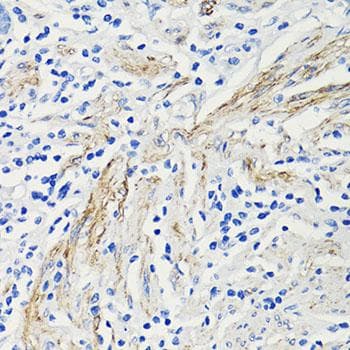 CCL4 / MIP-1 Beta Antibody