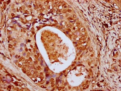 Polyclonal Rabbit anti-Human HIST1H4I Antibody (IHC)