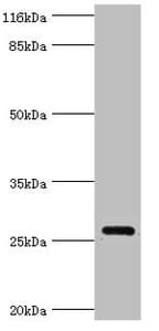 MRDS1 / OFCC1 Antibody (aa3-231)