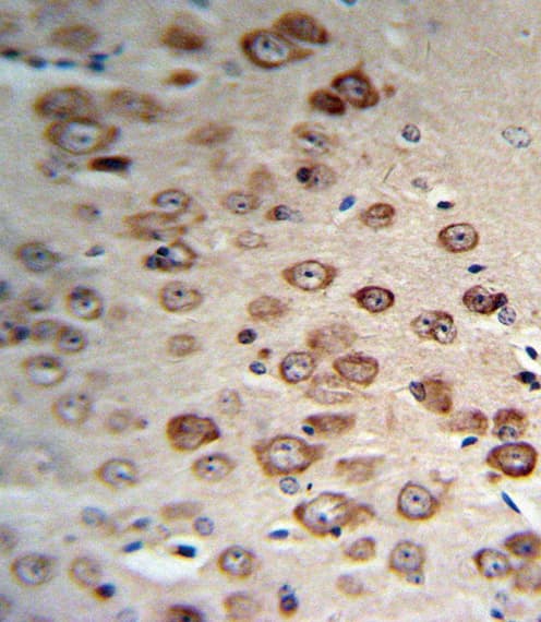 Polyclonal Rabbit anti-Human PCSK9 Antibody (aa144-173, IHC, WB)