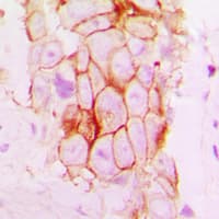 NOTCH2 Antibody (Internal)