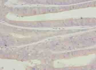 C9orf43 Antibody