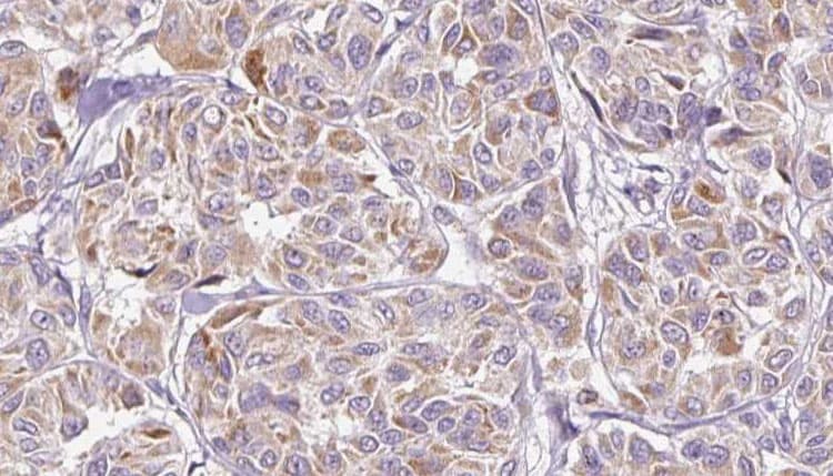 Leptin Antibody
