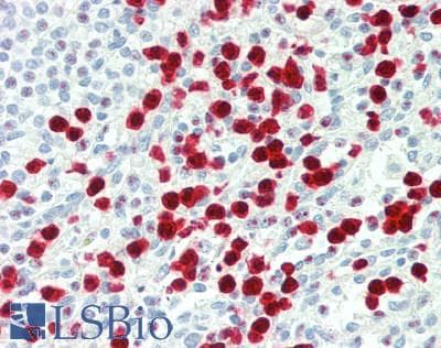 IHC-plus™ S100A12 Antibody