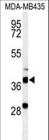 DHRS7 Antibody (aa66-93)