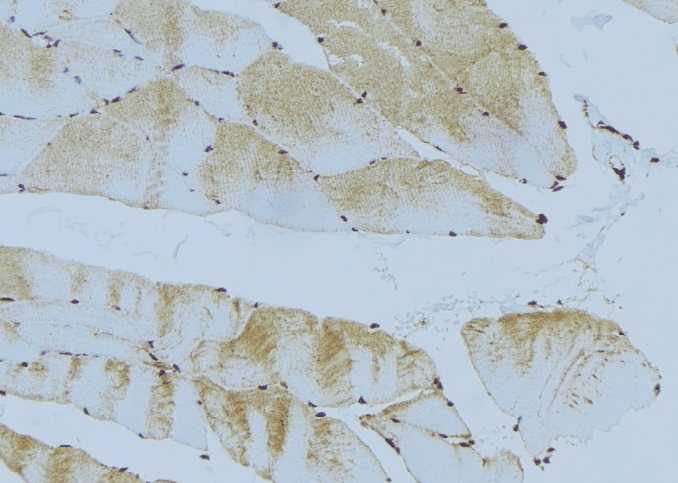 GSTM2 Antibody