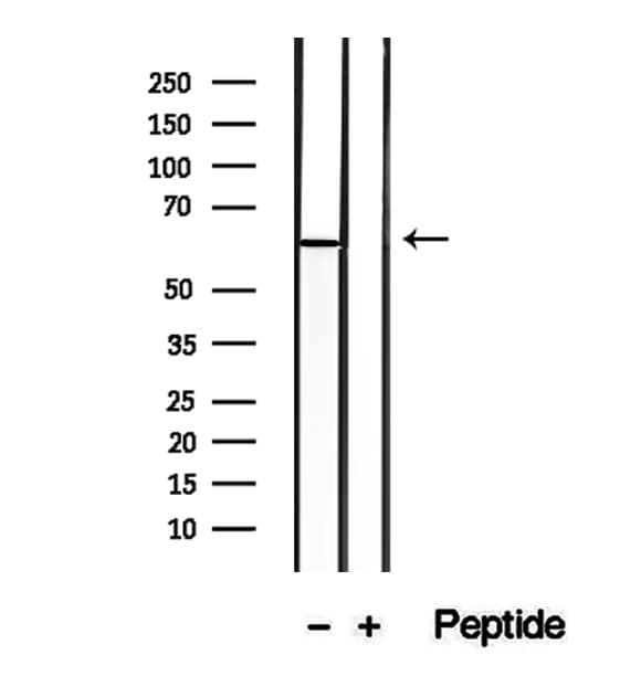 DPP4 / CD26 Antibody