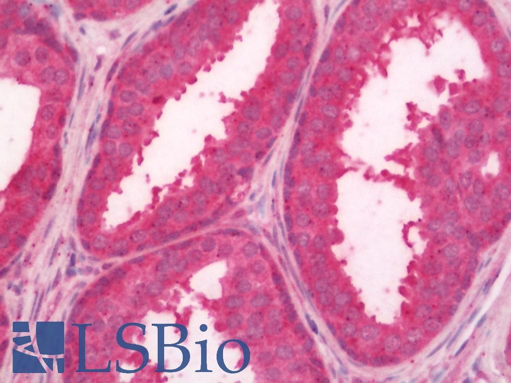 IHC-plus™ JAG1 / Jagged 1 Antibody