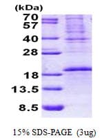 Human OCIAD2 Protein (Recombinant His)