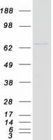 Human DDX41 / ABS Protein (Recombinant Myc-DDK (Flag))